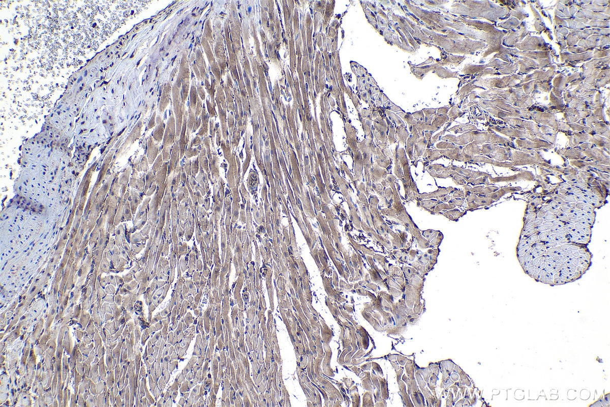 Immunohistochemical analysis of paraffin-embedded rat heart tissue slide using KHC1027 (PPP3CA IHC Kit).