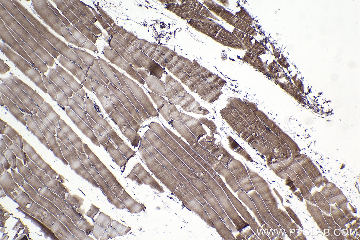 Immunohistochemical analysis of paraffin-embedded mouse skeletal muscle tissue slide using KHC1027 (PPP3CA IHC Kit).