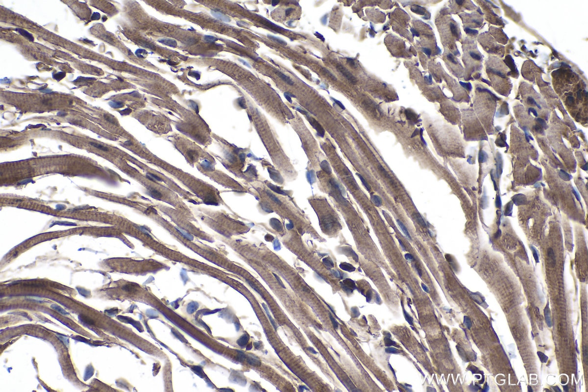 Immunohistochemical analysis of paraffin-embedded mouse heart tissue slide using KHC1027 (PPP3CA IHC Kit).