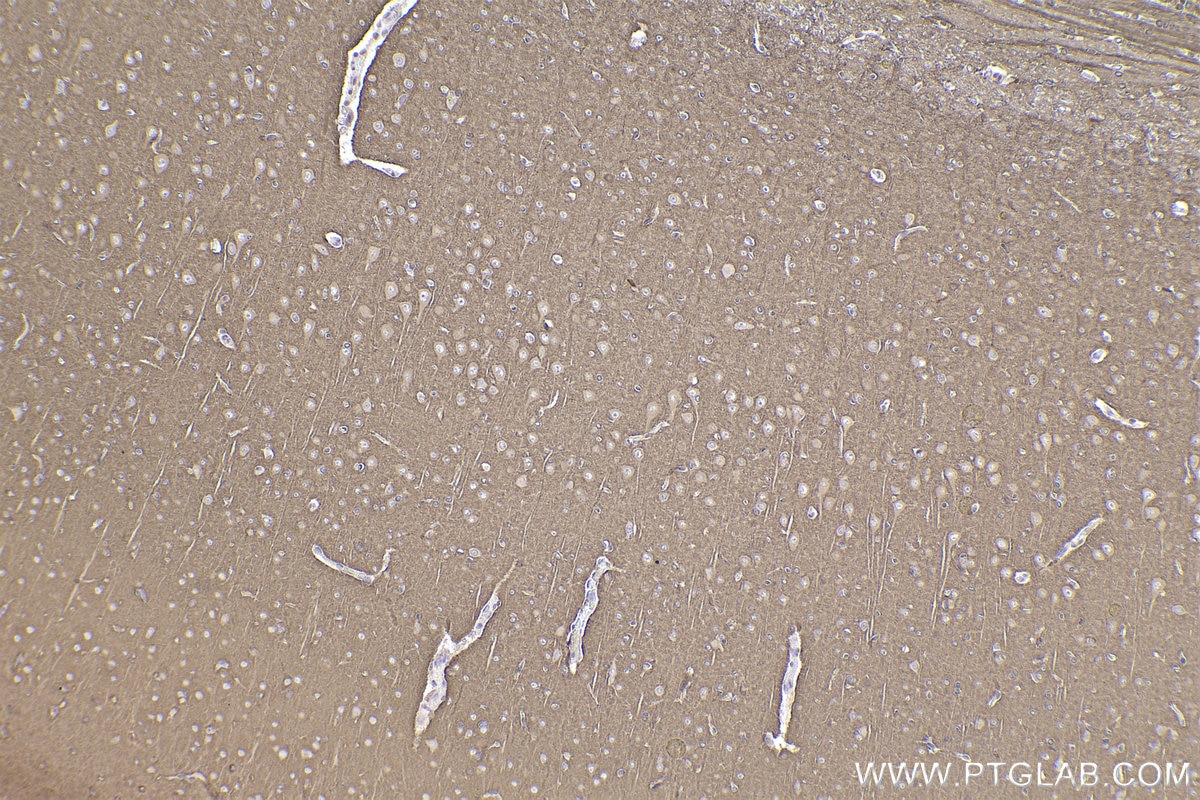Immunohistochemical analysis of paraffin-embedded rat brain tissue slide using KHC2358 (PPP3R1 IHC Kit).