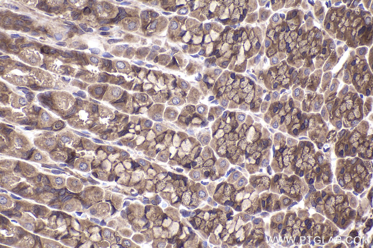 Immunohistochemical analysis of paraffin-embedded rat stomach tissue slide using KHC2358 (PPP3R1 IHC Kit).