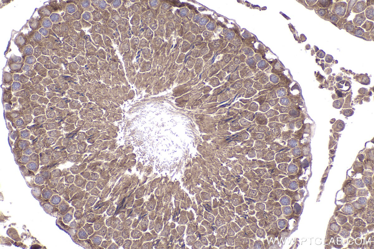 Immunohistochemical analysis of paraffin-embedded rat testis tissue slide using KHC2358 (PPP3R1 IHC Kit).