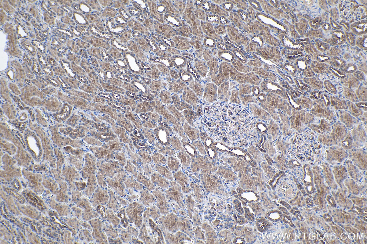 Immunohistochemical analysis of paraffin-embedded human kidney tissue slide using KHC1013 (PPP6C IHC Kit).