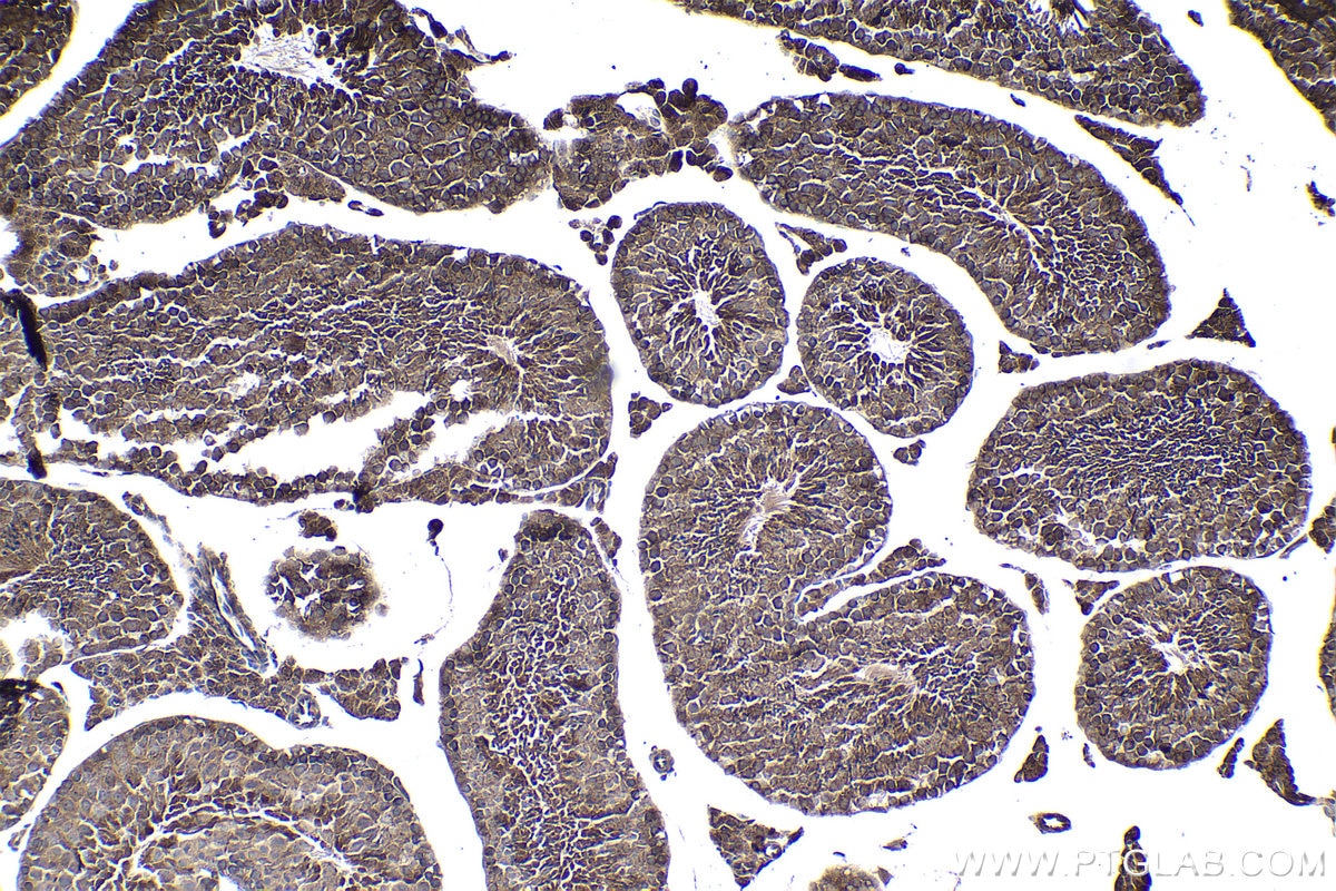 Immunohistochemical analysis of paraffin-embedded mouse testis tissue slide using KHC1013 (PPP6C IHC Kit).