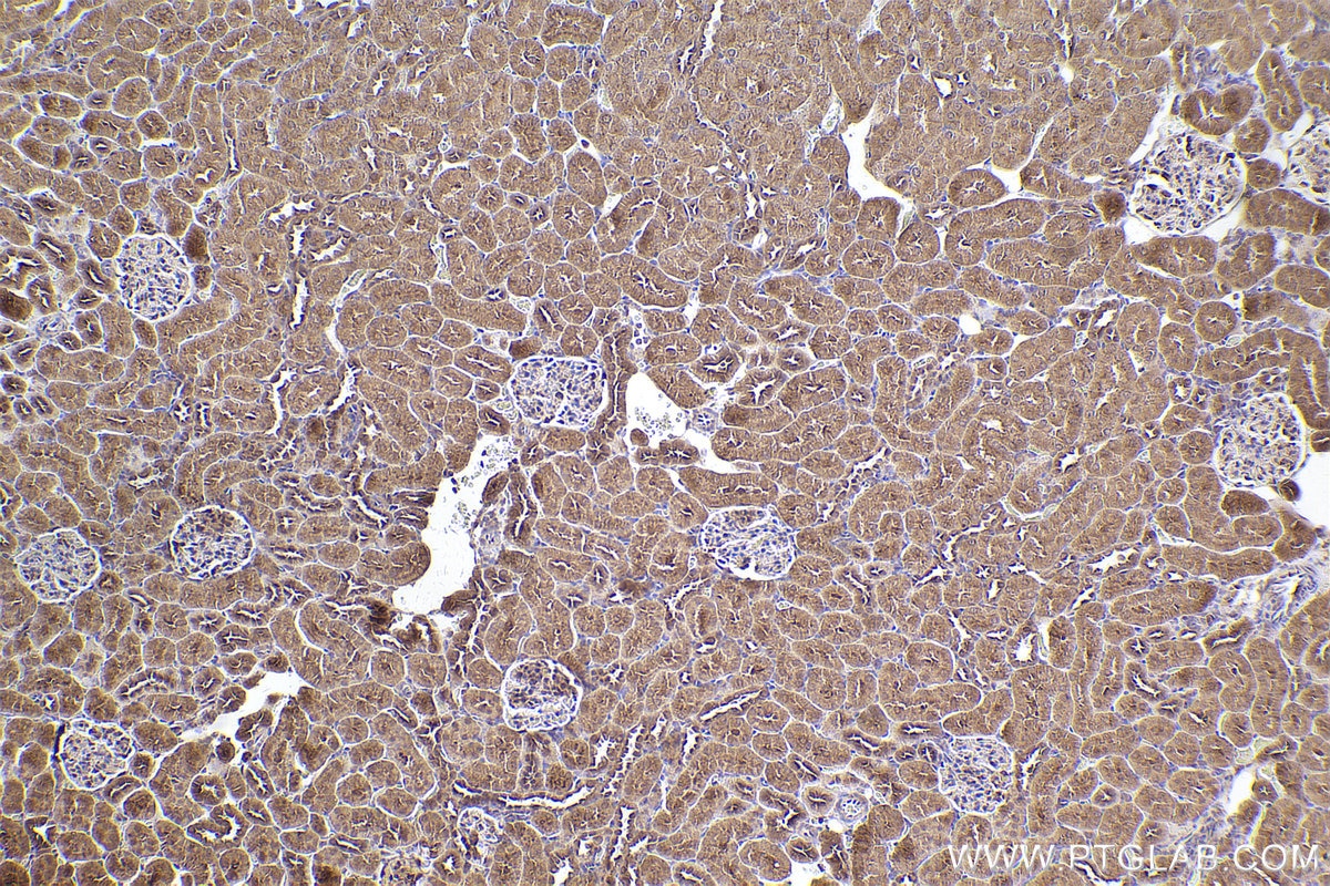 Immunohistochemical analysis of paraffin-embedded rat kidney tissue slide using KHC2543 (PPP6R3/SAPS3 IHC Kit).