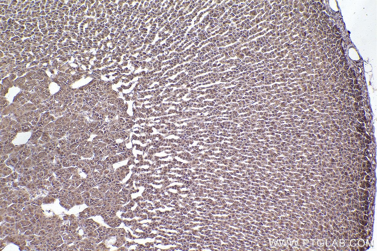 Immunohistochemical analysis of paraffin-embedded rat adrenal gland tissue slide using KHC2543 (PPP6R3/SAPS3 IHC Kit).
