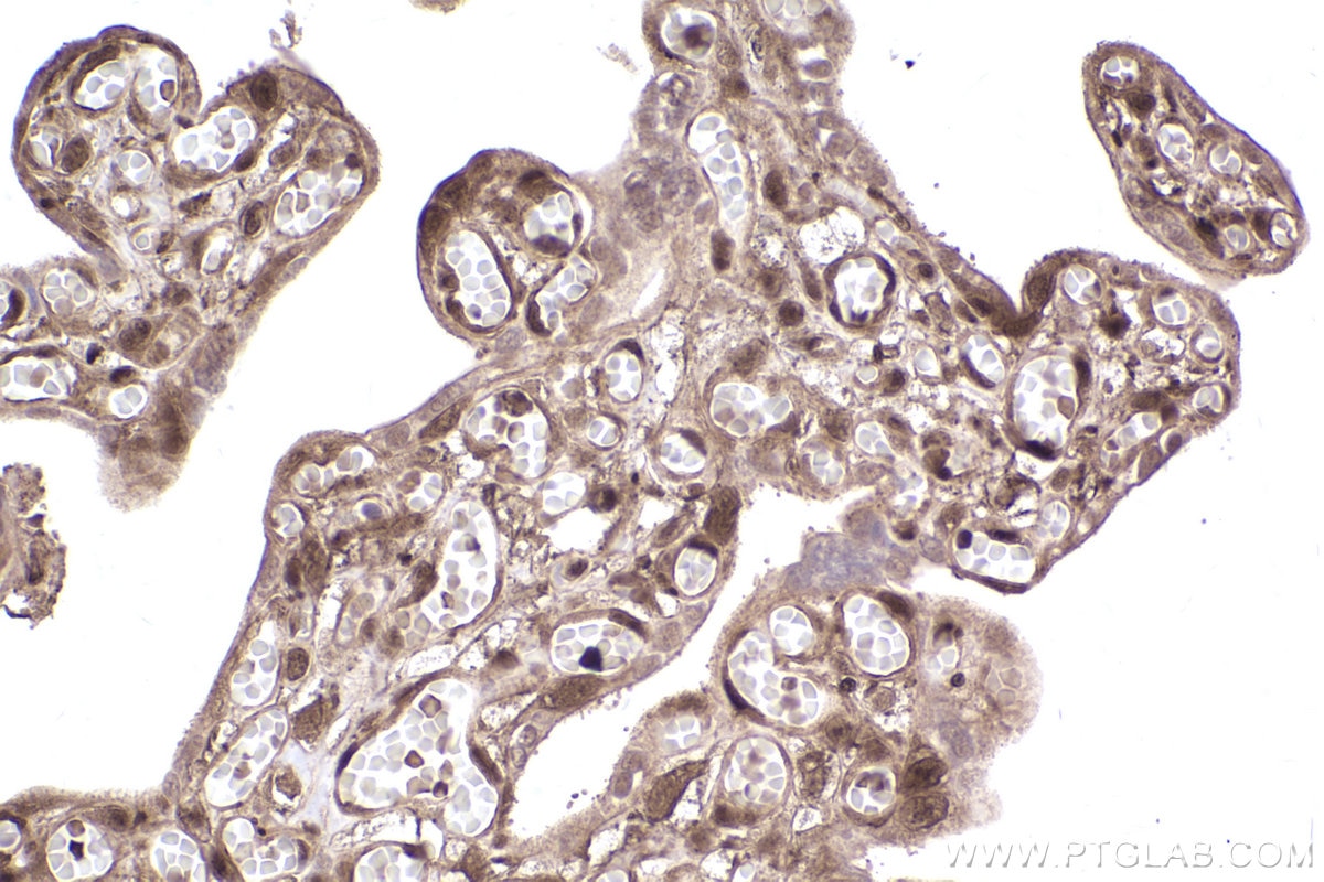 Immunohistochemical analysis of paraffin-embedded human placenta tissue slide using KHC2543 (PPP6R3/SAPS3 IHC Kit).
