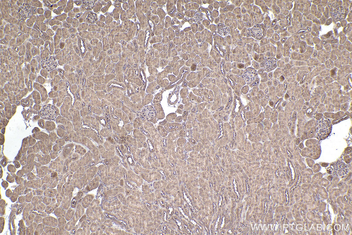 Immunohistochemical analysis of paraffin-embedded mouse kidney tissue slide using KHC2543 (PPP6R3/SAPS3 IHC Kit).