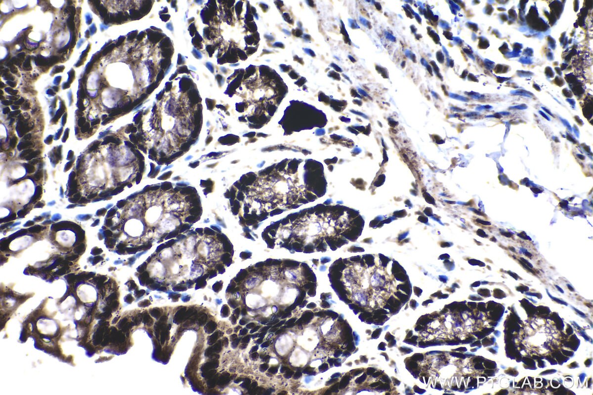 Immunohistochemical analysis of paraffin-embedded mouse colon tissue slide using KHC1383 (PQBP1 IHC Kit).