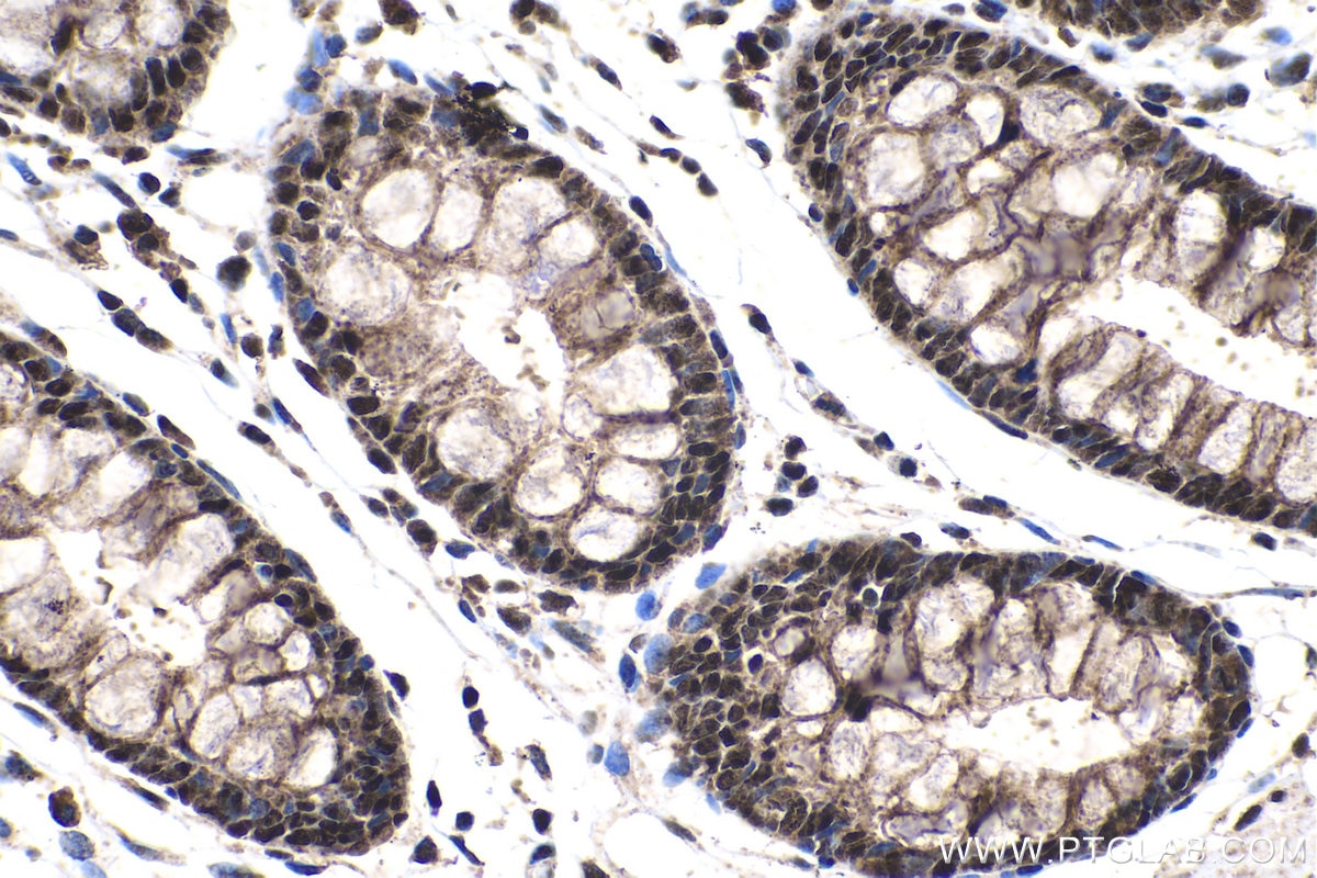 Immunohistochemical analysis of paraffin-embedded human colon tissue slide using KHC1383 (PQBP1 IHC Kit).