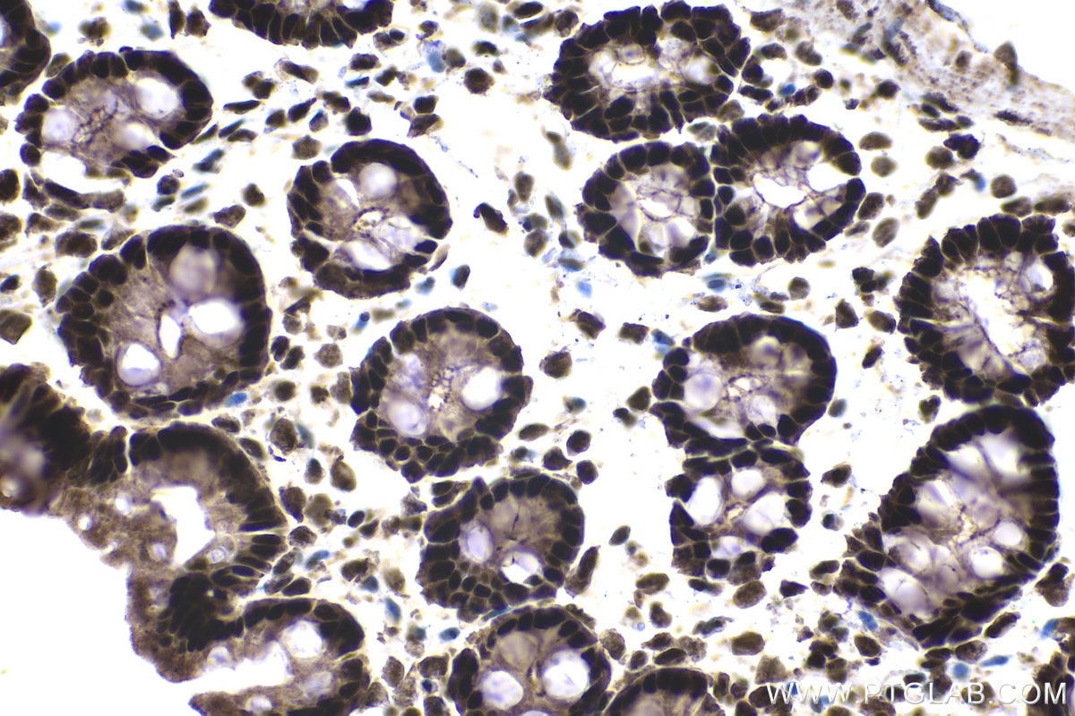 Immunohistochemical analysis of paraffin-embedded rat colon tissue slide using KHC1383 (PQBP1 IHC Kit).