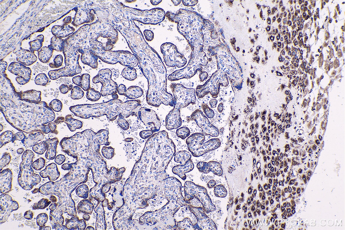 Immunohistochemical analysis of paraffin-embedded human placenta tissue slide using KHC0562 (PRDX3 IHC Kit).