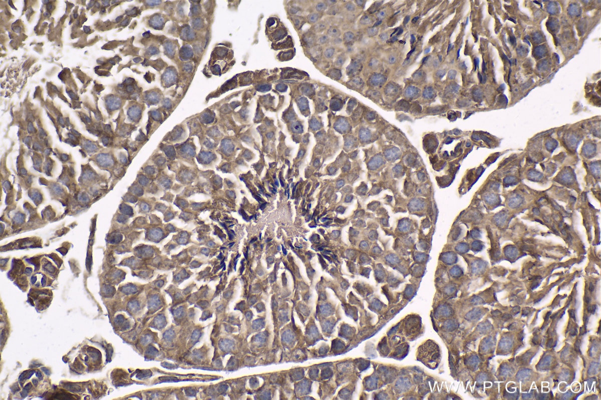 Immunohistochemical analysis of paraffin-embedded mouse testis tissue slide using KHC1880 (PRICKLE1 IHC Kit).