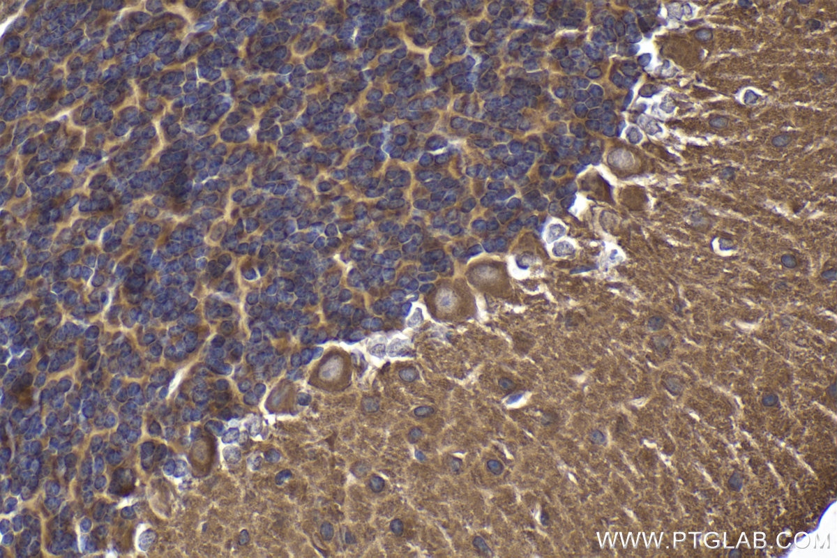 Immunohistochemical analysis of paraffin-embedded mouse cerebellum tissue slide using KHC1880 (PRICKLE1 IHC Kit).