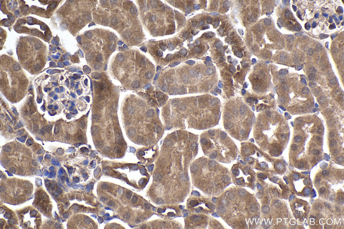 Immunohistochemical analysis of paraffin-embedded mouse kidney tissue slide using KHC1880 (PRICKLE1 IHC Kit).