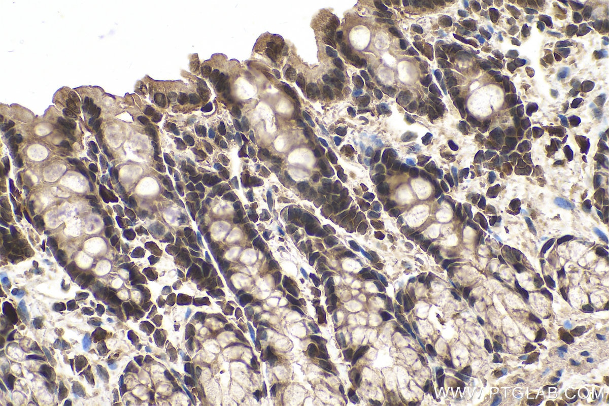 Immunohistochemical analysis of paraffin-embedded rat colon tissue slide using KHC0600 (AMPK Alpha 1 IHC Kit).