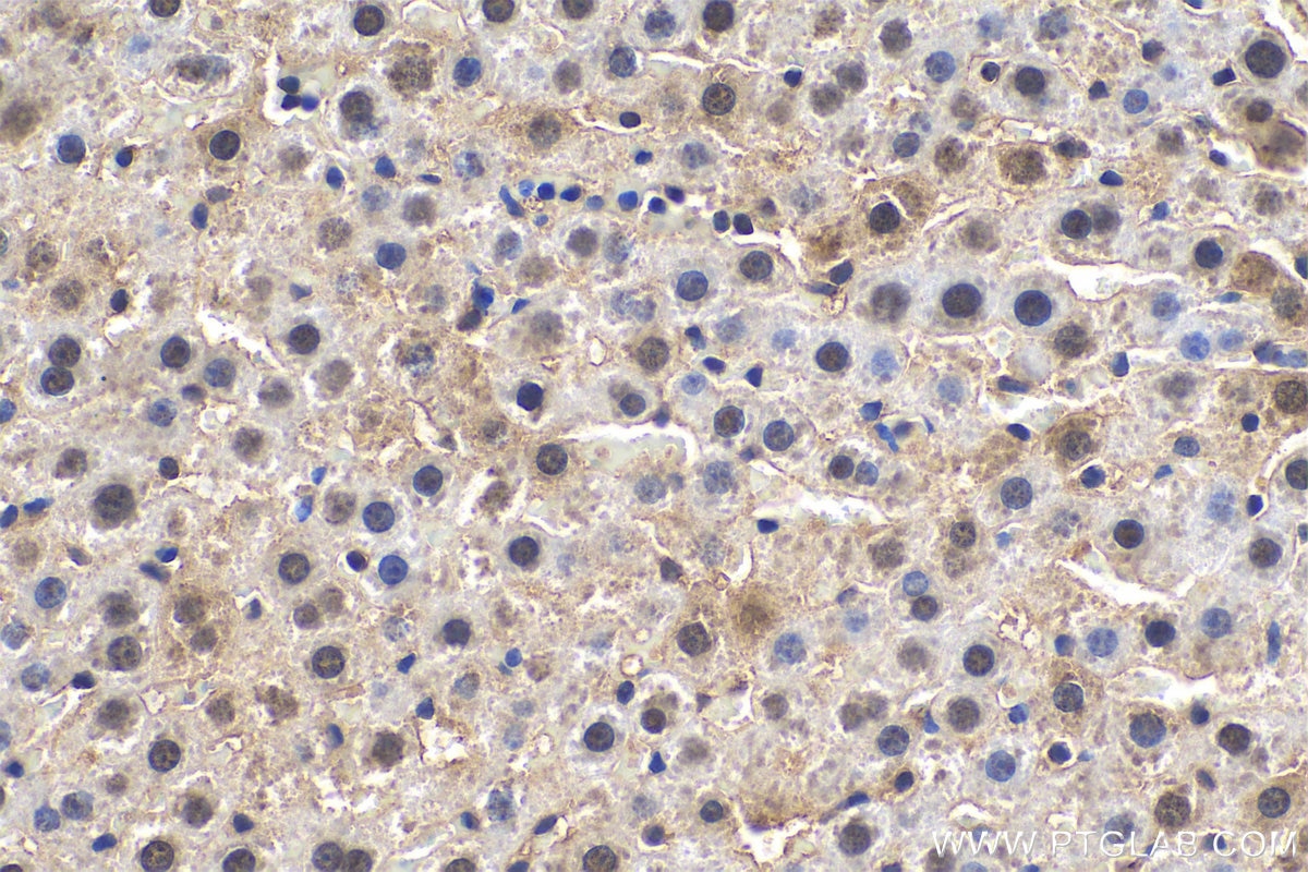 Immunohistochemical analysis of paraffin-embedded rat liver tissue slide using KHC0600 (AMPK Alpha 1 IHC Kit).