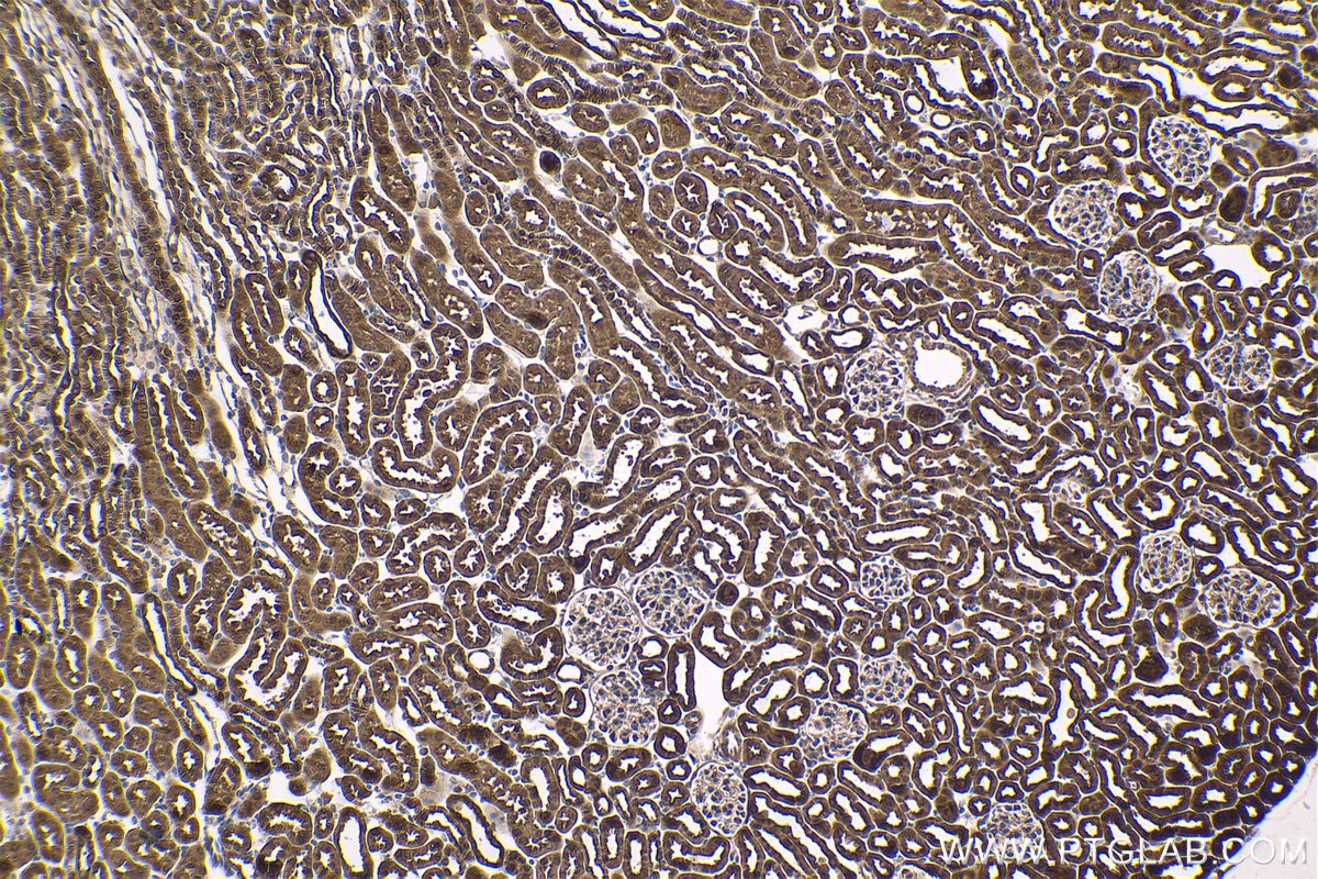 Immunohistochemical analysis of paraffin-embedded mouse kidney tissue slide using KHC1628 (PRKAA2 IHC Kit).