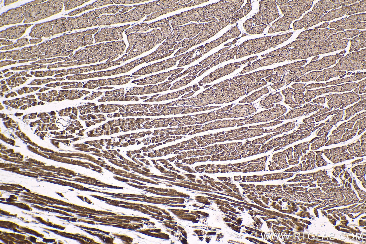 Immunohistochemical analysis of paraffin-embedded rat heart tissue slide using KHC1628 (PRKAA2 IHC Kit).