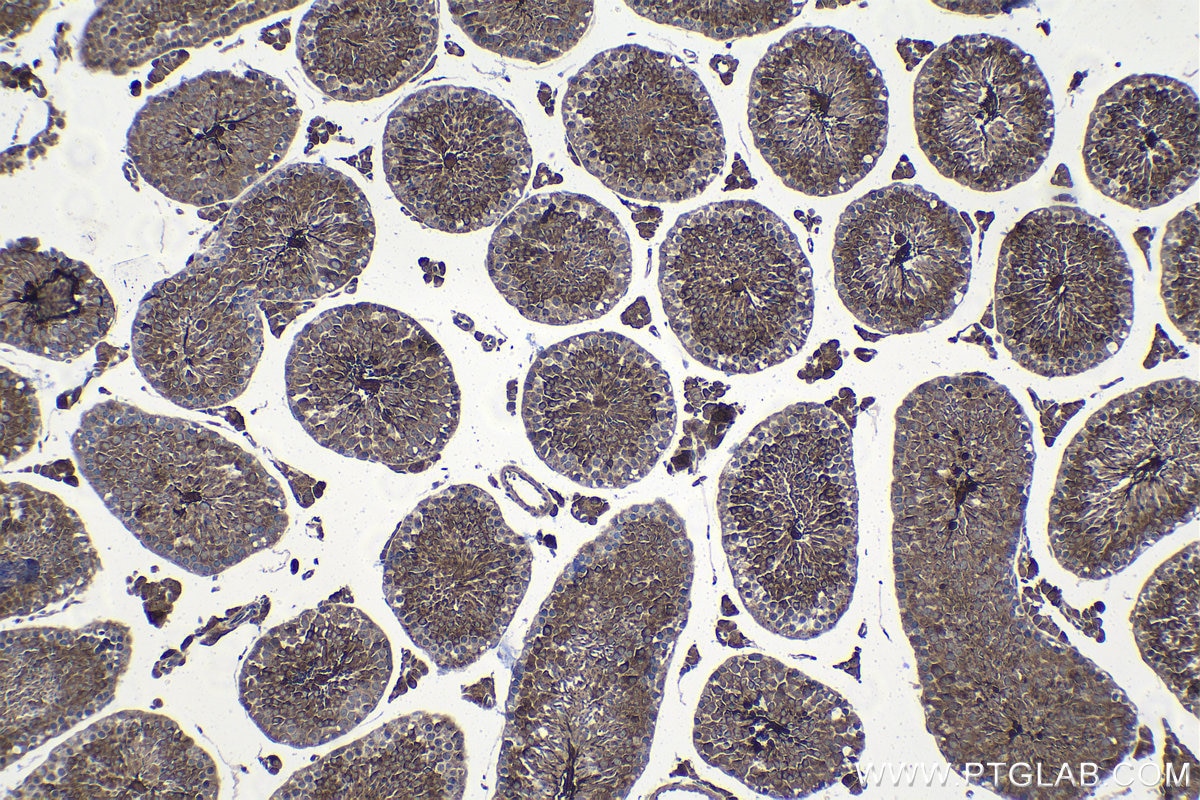 Immunohistochemical analysis of paraffin-embedded mouse testis tissue slide using KHC1540 (PRKACA IHC Kit).