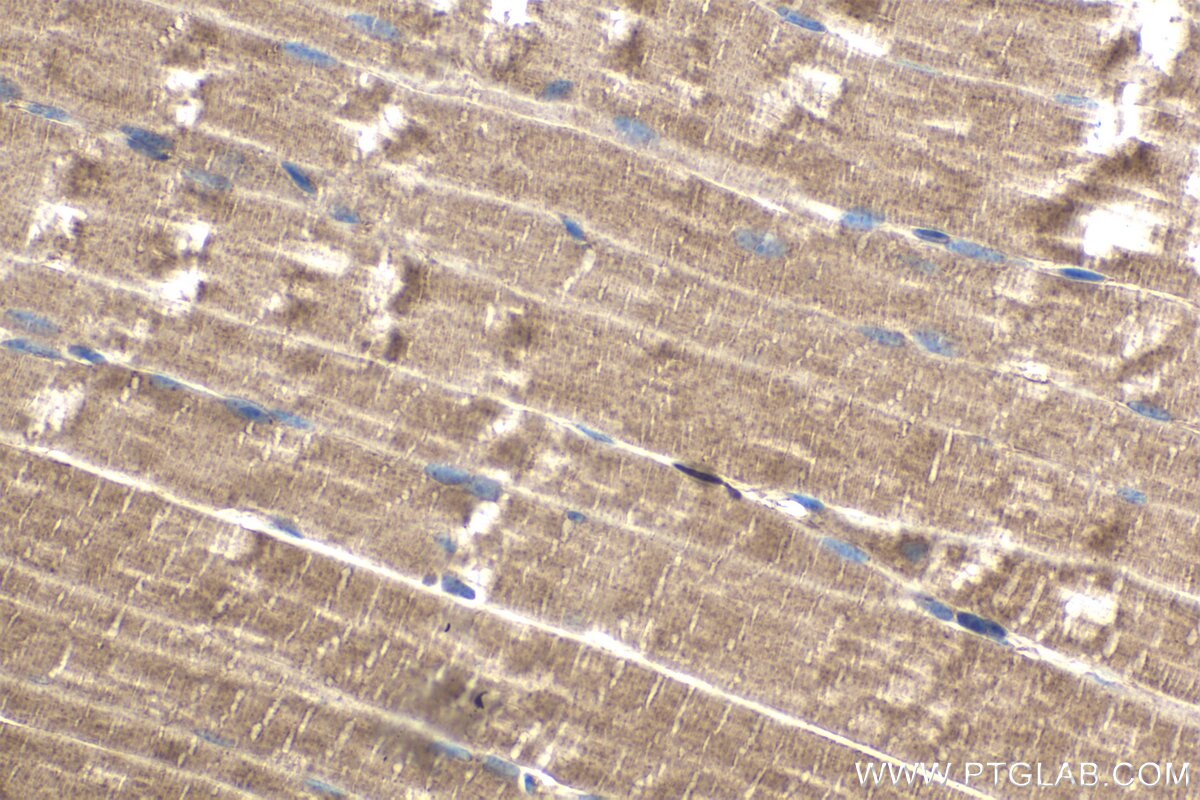 Immunohistochemical analysis of paraffin-embedded mouse skeletal muscle tissue slide using KHC1540 (PRKACA IHC Kit).