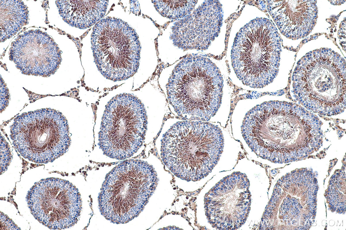 Immunohistochemical analysis of paraffin-embedded rat testis tissue slide using KHC0924 (PRKAR2A IHC Kit).