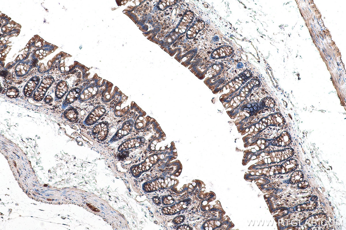 Immunohistochemical analysis of paraffin-embedded rat colon tissue slide using KHC0924 (PRKAR2A IHC Kit).