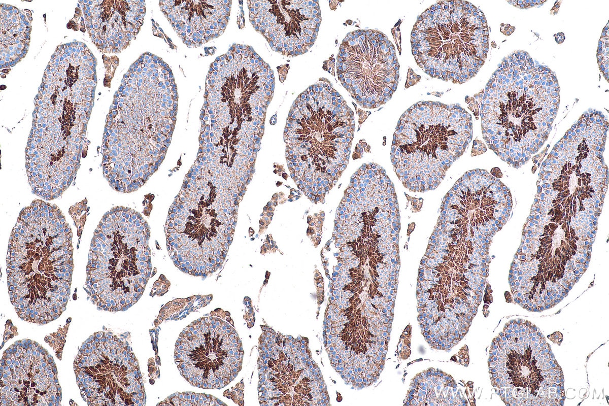 Immunohistochemical analysis of paraffin-embedded mouse testis tissue slide using KHC0924 (PRKAR2A IHC Kit).