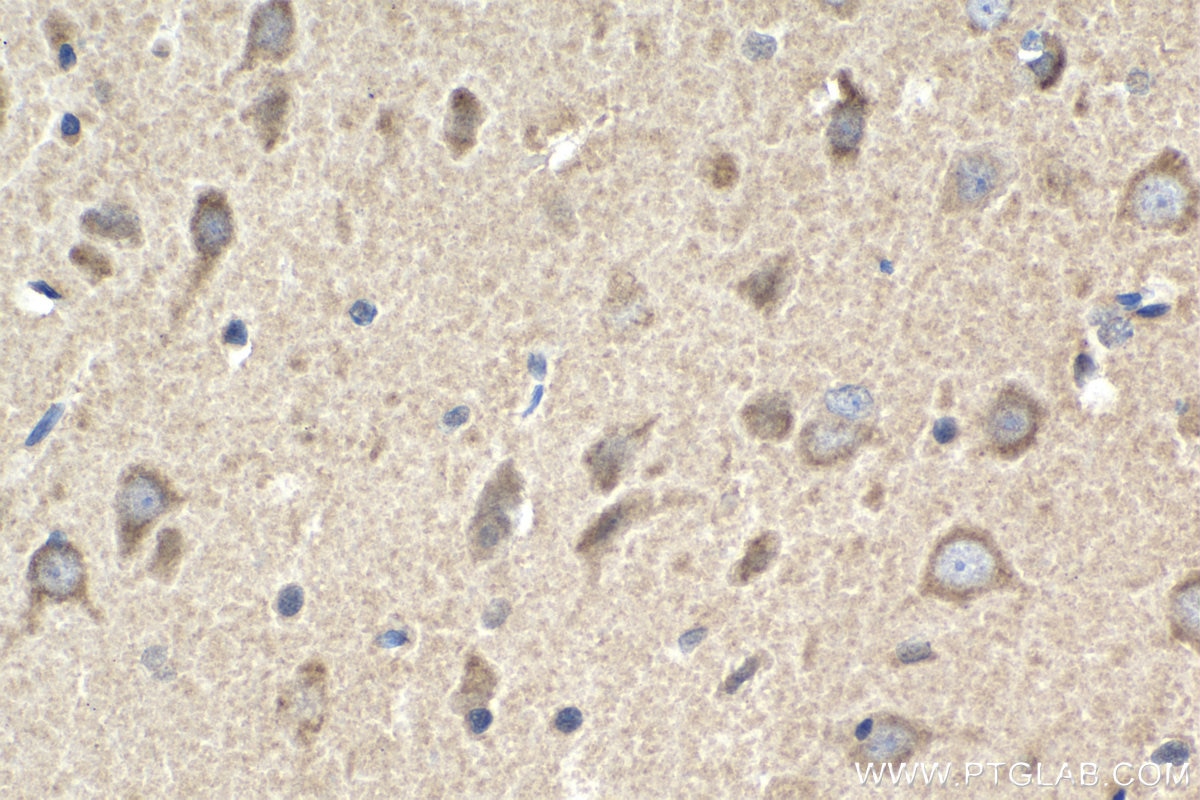 Immunohistochemical analysis of paraffin-embedded rat brain tissue slide using KHC1510 (PRKCB IHC Kit).