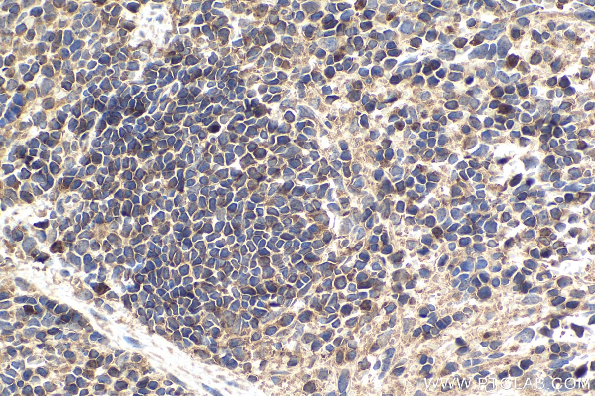 Immunohistochemical analysis of paraffin-embedded mouse spleen tissue slide using KHC1510 (PRKCB IHC Kit).
