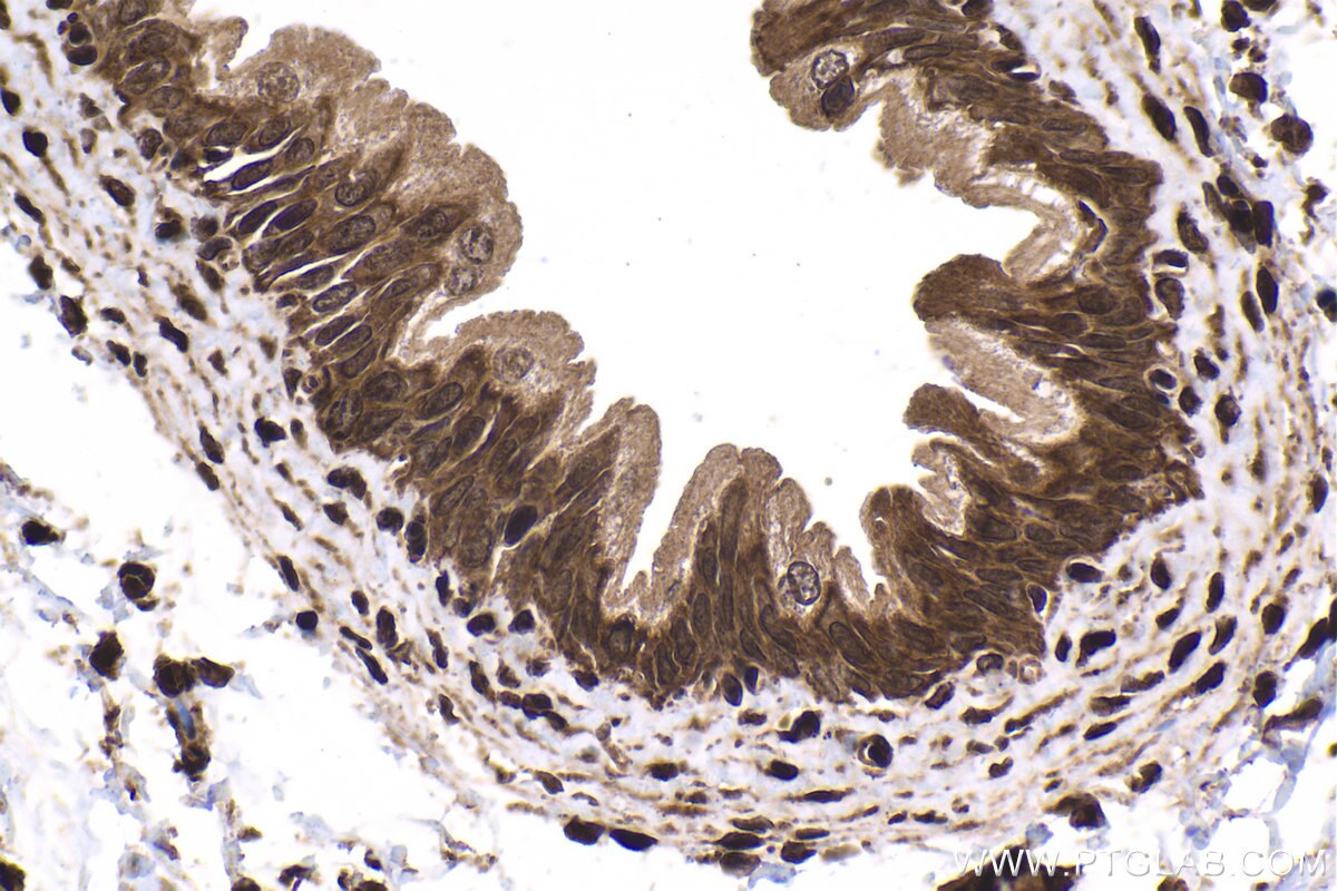 Immunohistochemical analysis of paraffin-embedded rat bladder tissue slide using KHC1676 (PRKCD IHC Kit).