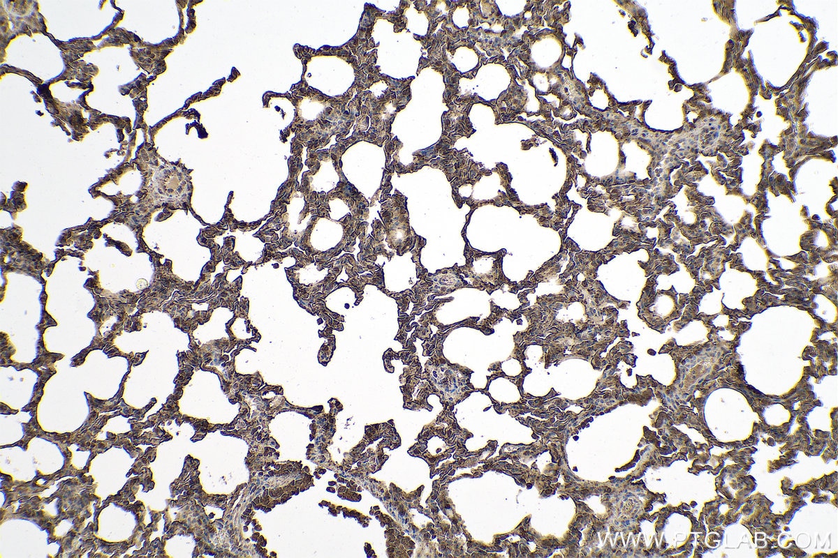 Immunohistochemical analysis of paraffin-embedded rat lung tissue slide using KHC0786 (PRKCI IHC Kit).