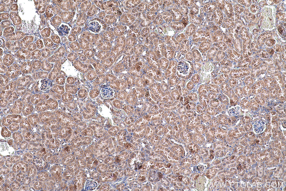 Immunohistochemical analysis of paraffin-embedded mouse kidney tissue slide using KHC0698 (PRKCSH IHC Kit).