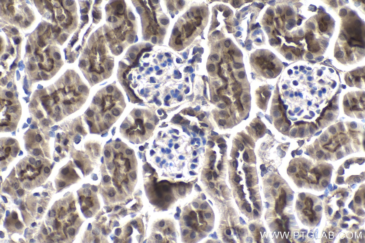 Immunohistochemical analysis of paraffin-embedded mouse kidney tissue slide using KHC1911 (PRKD2 IHC Kit).