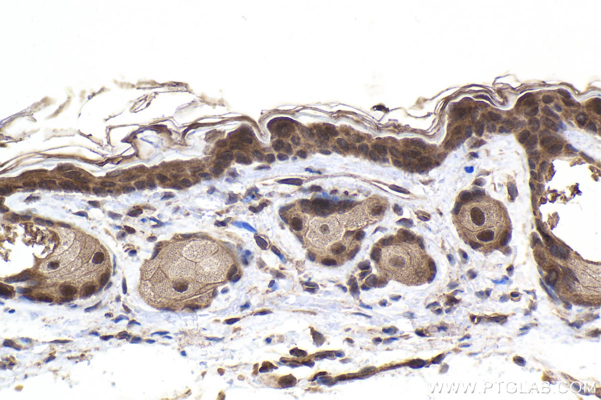 Immunohistochemical analysis of paraffin-embedded mouse skin tissue slide using KHC1911 (PRKD2 IHC Kit).