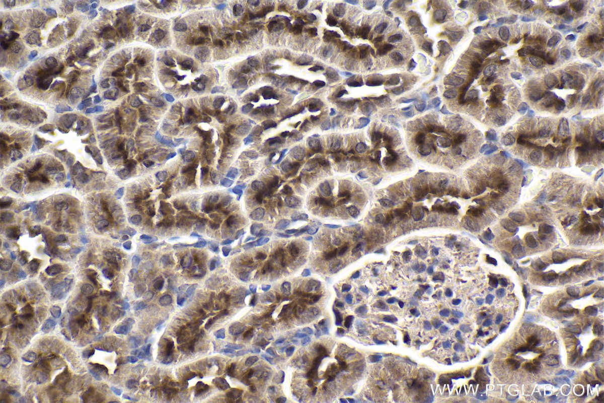 Immunohistochemical analysis of paraffin-embedded rat kidney tissue slide using KHC1911 (PRKD2 IHC Kit).