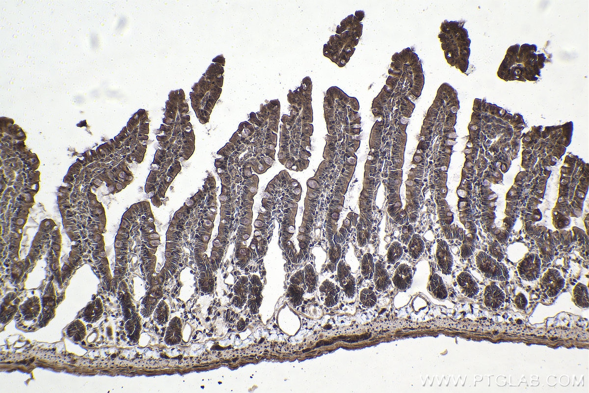 Immunohistochemical analysis of paraffin-embedded rat small intestine tissue slide using KHC1911 (PRKD2 IHC Kit).