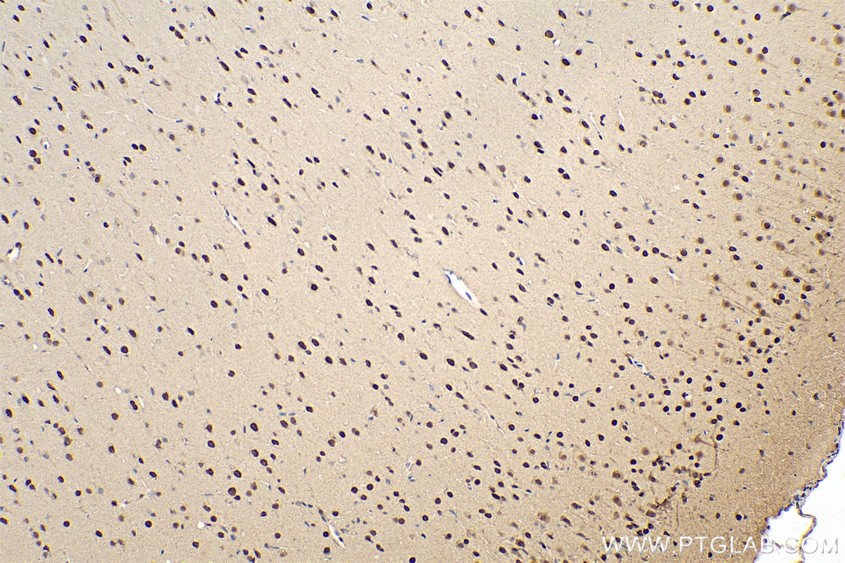 Immunohistochemical analysis of paraffin-embedded rat brain tissue slide using KHC0832 (PRMT1 IHC Kit).