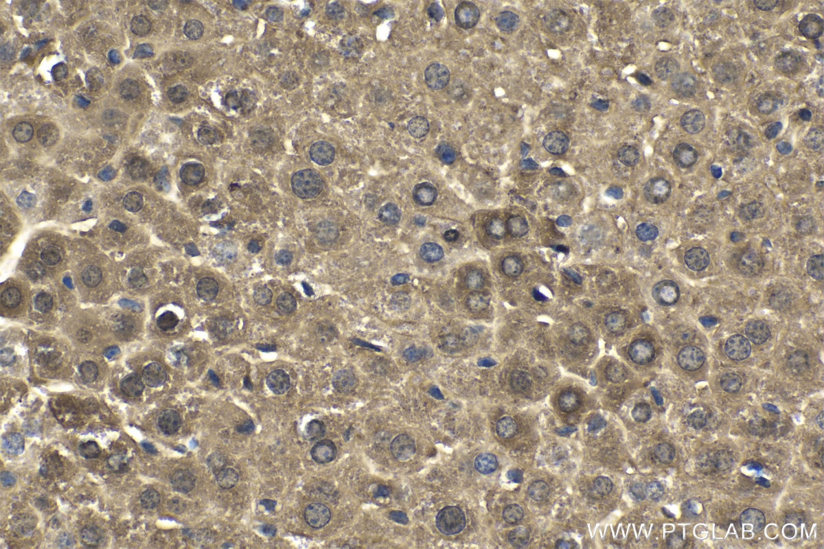 Immunohistochemical analysis of paraffin-embedded mouse liver tissue slide using KHC1630 (PRMT2 IHC Kit).