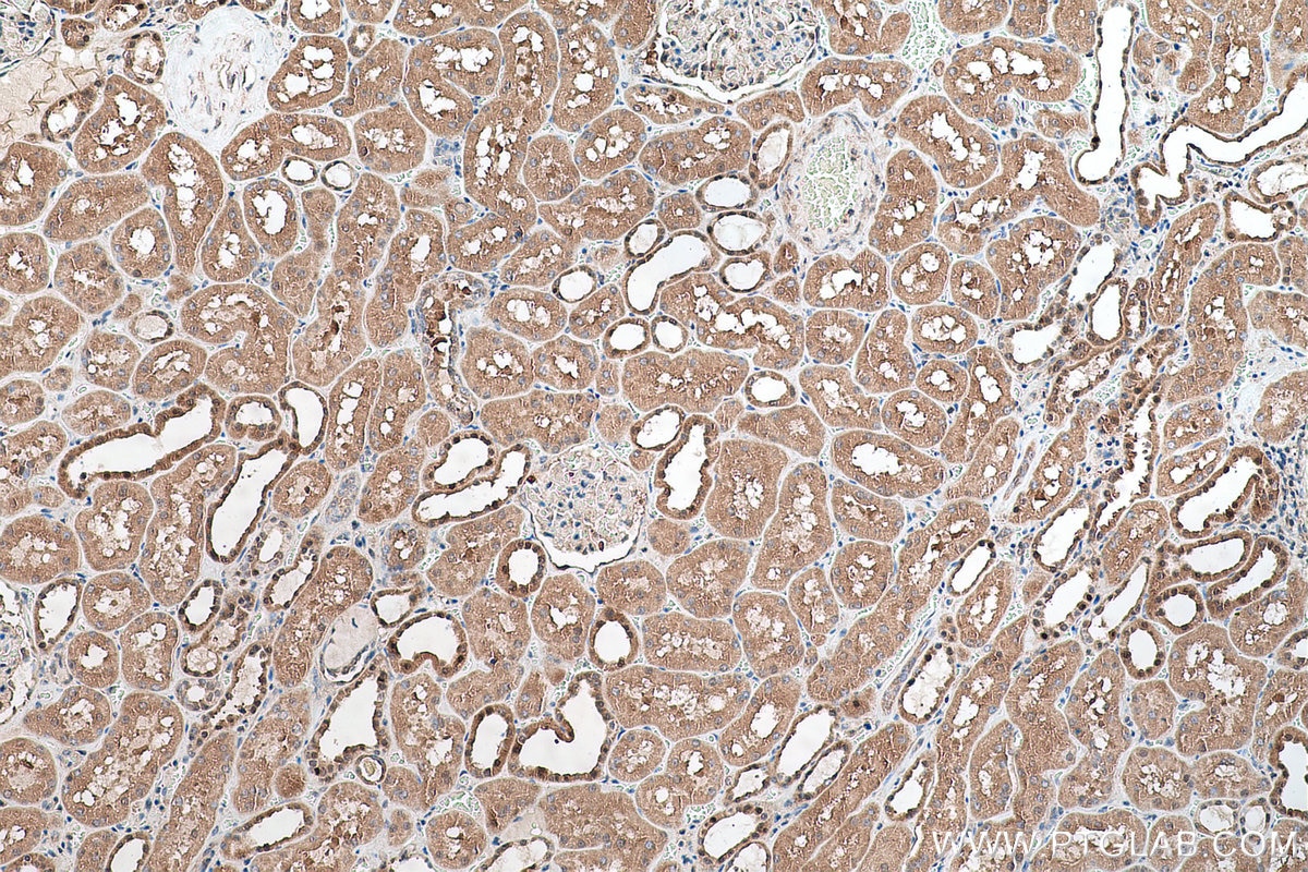 Immunohistochemical analysis of paraffin-embedded human kidney tissue slide using KHC0636 (PRMT5 IHC Kit).