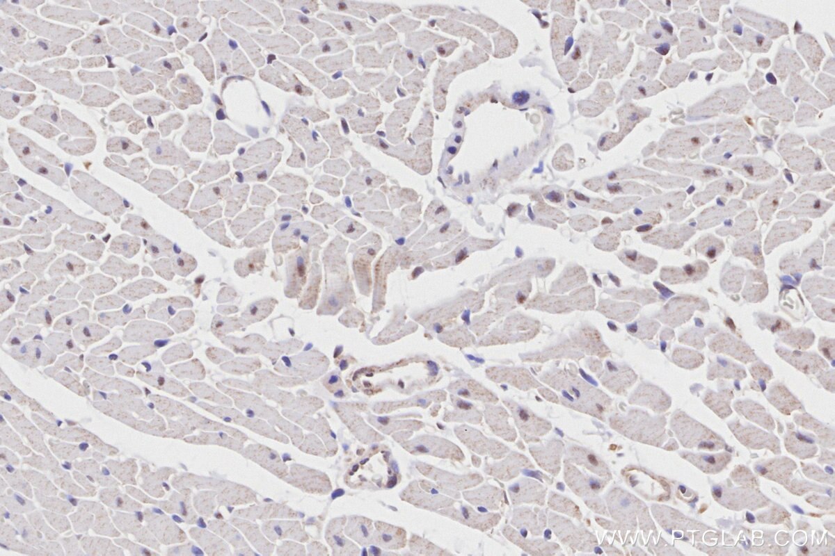 Immunohistochemical analysis of paraffin-embedded rat heart tissue slide using KHC2760 (PROX1 IHC Kit).