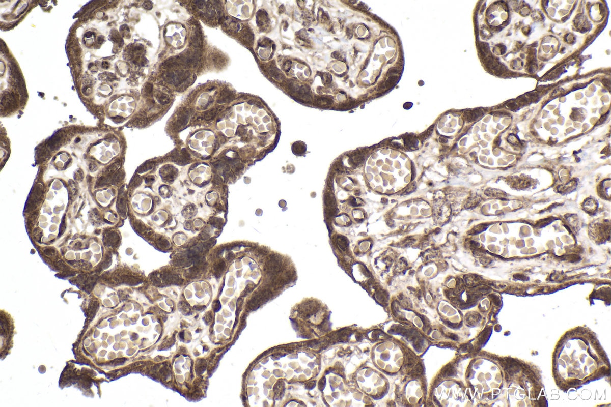 Immunohistochemical analysis of paraffin-embedded human placenta tissue slide using KHC2000 (PRPF19 IHC Kit).