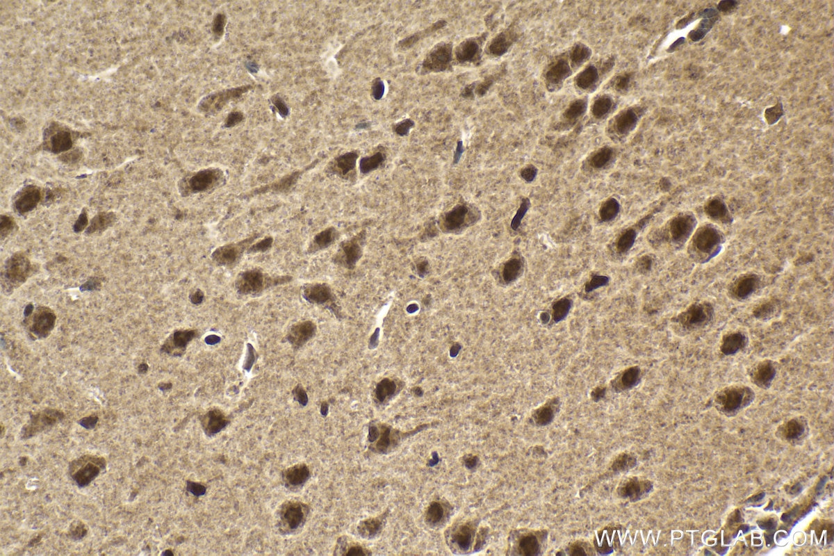 Immunohistochemical analysis of paraffin-embedded mouse brain tissue slide using KHC2000 (PRPF19 IHC Kit).