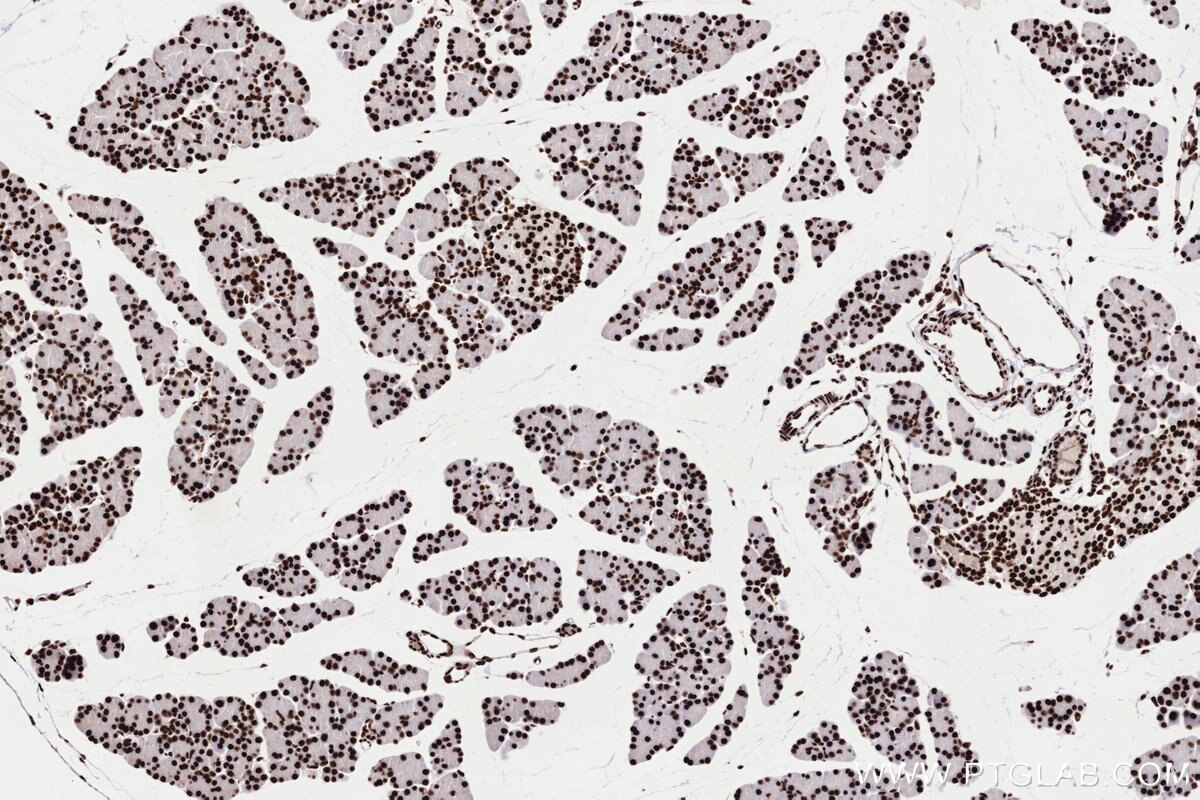 Immunohistochemical analysis of paraffin-embedded rat pancreas tissue slide using KHC3303 (PRPF31 IHC Kit).