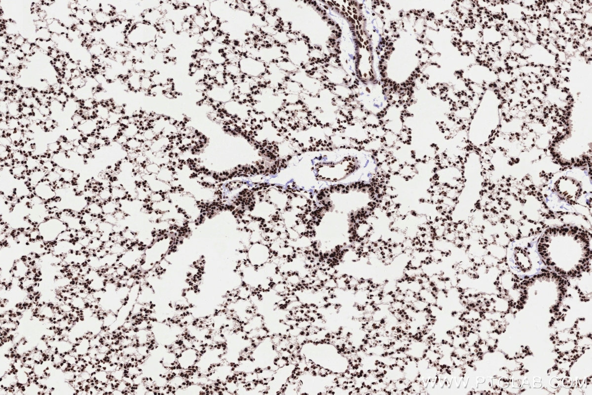 Immunohistochemical analysis of paraffin-embedded mouse lung tissue slide using KHC3303 (PRPF31 IHC Kit).