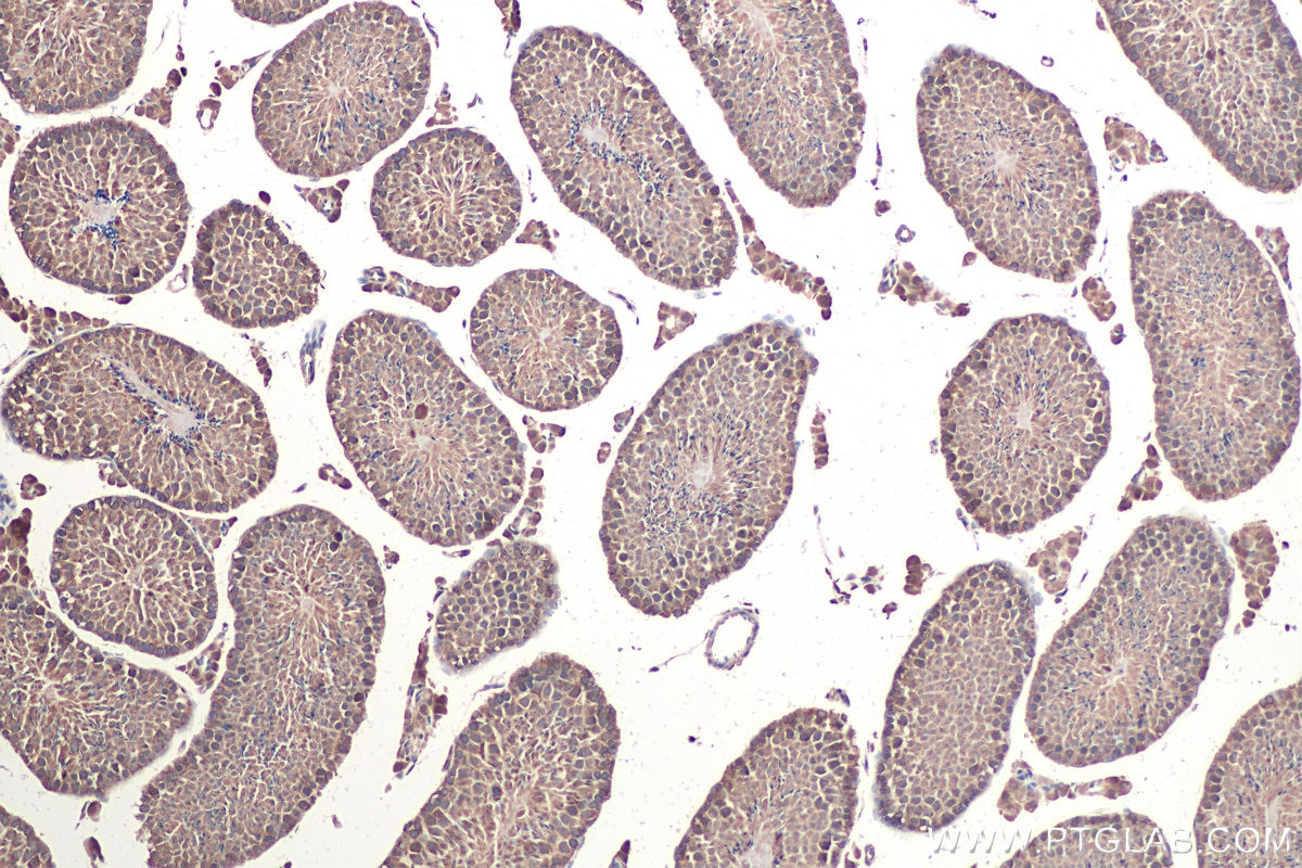 Immunohistochemical analysis of paraffin-embedded mouse testis tissue slide using KHC0919 (PRPSAP1 IHC Kit).
