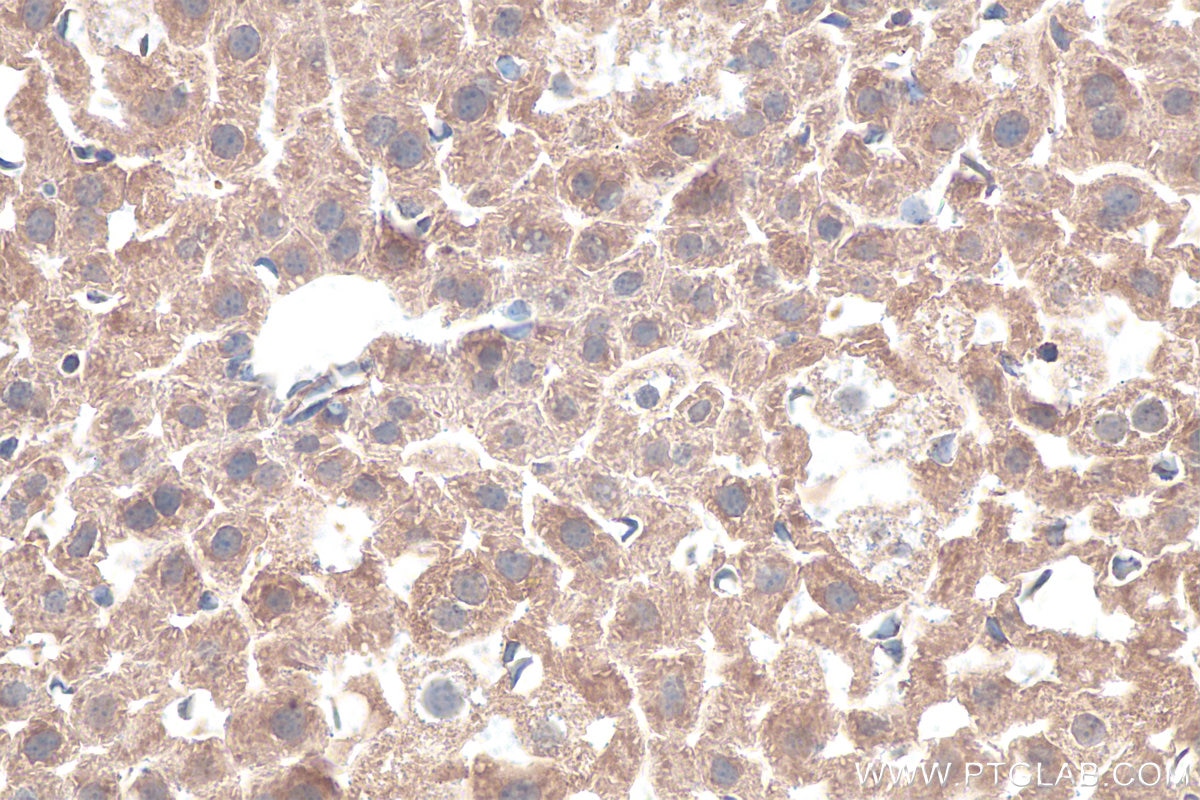 Immunohistochemical analysis of paraffin-embedded mouse liver tissue slide using KHC0919 (PRPSAP1 IHC Kit).