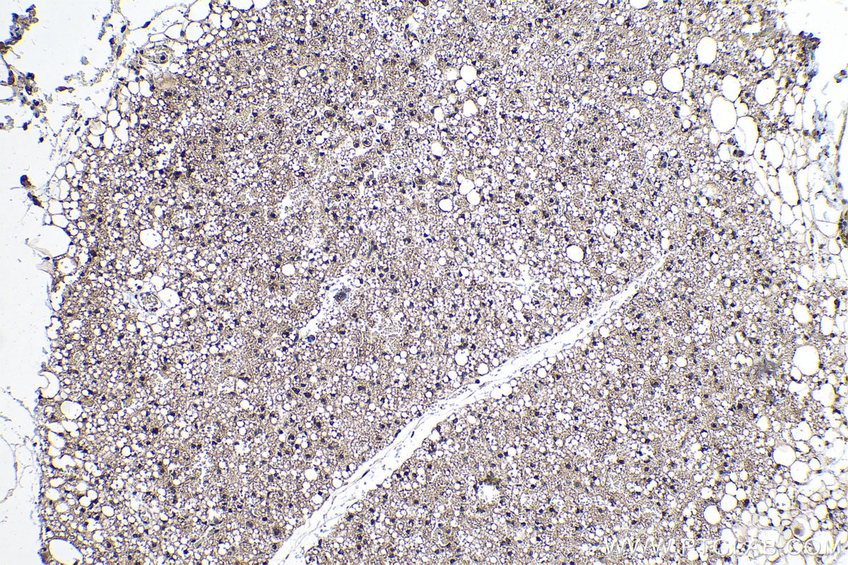 Immunohistochemical analysis of paraffin-embedded rat brown adipose tissue slide using KHC0243 (PSEN1/AD3 IHC Kit).
