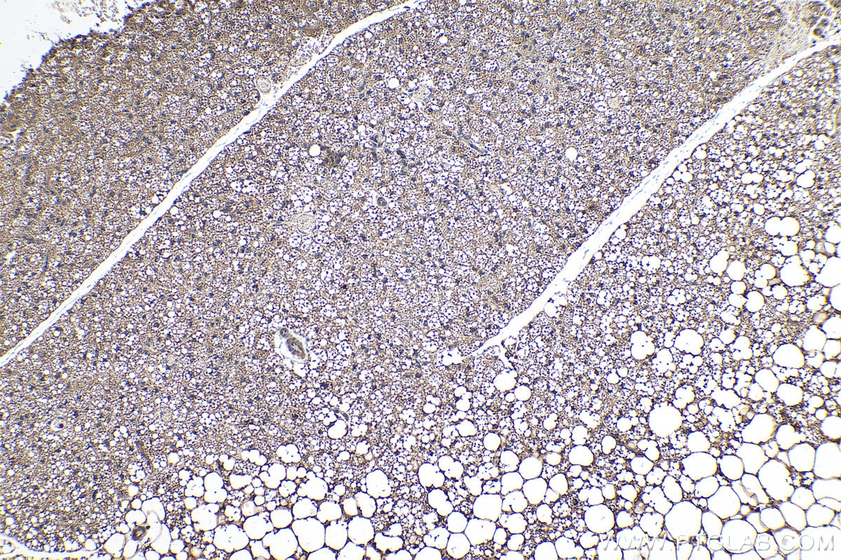 Immunohistochemical analysis of paraffin-embedded mouse brown adipose tissue slide using KHC0243 (PSEN1/AD3 IHC Kit).