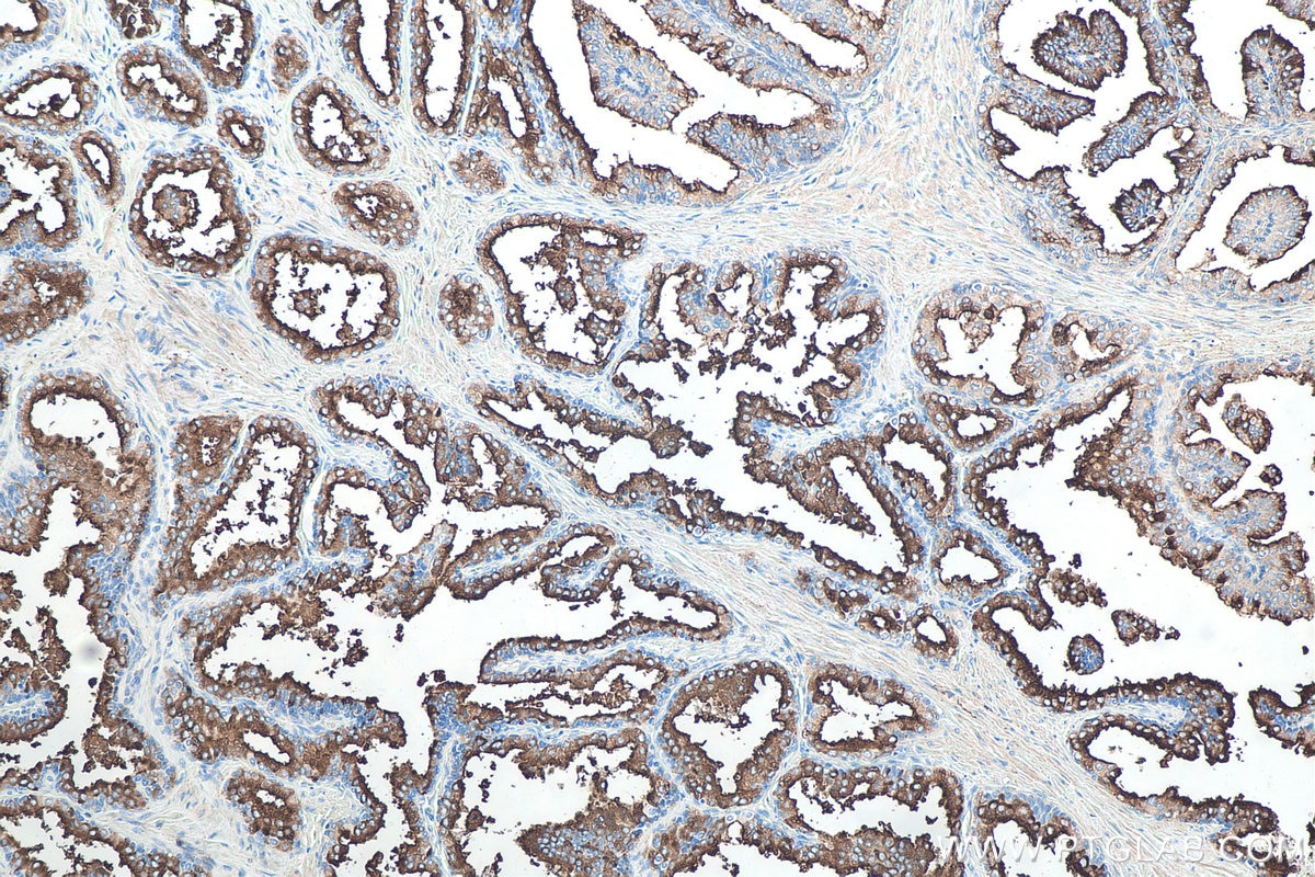 Immunohistochemical analysis of paraffin-embedded human prostate hyperplasia tissue slide using KHC0066 (PSMA/FOLH1 IHC Kit).